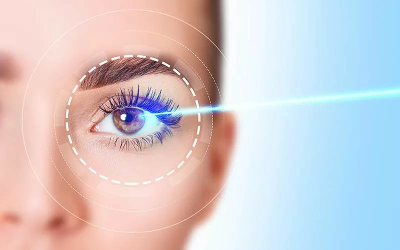 LASIK Eye Surgery: