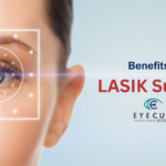 Benefits of LASIK Surgery