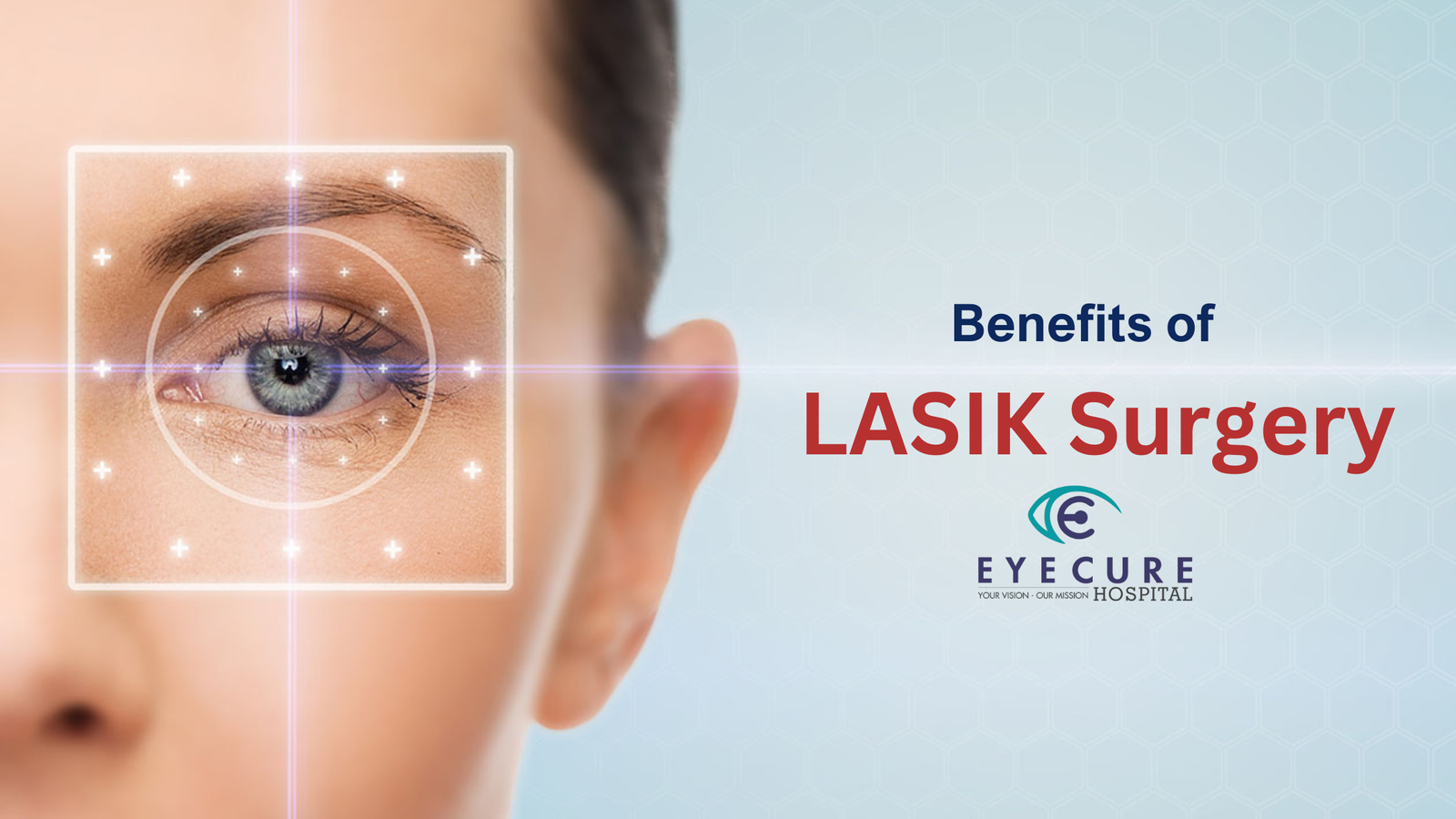 Benefits of LASIK Surgery