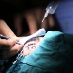 Cataract Surgery in Secunderabad