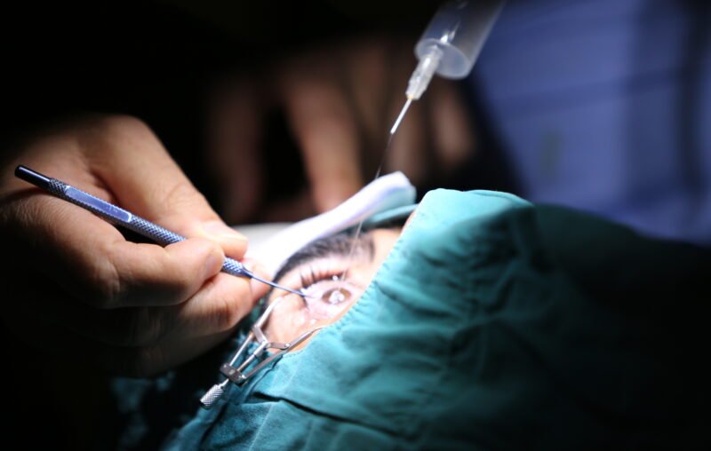 Cataract Surgery in Secunderabad