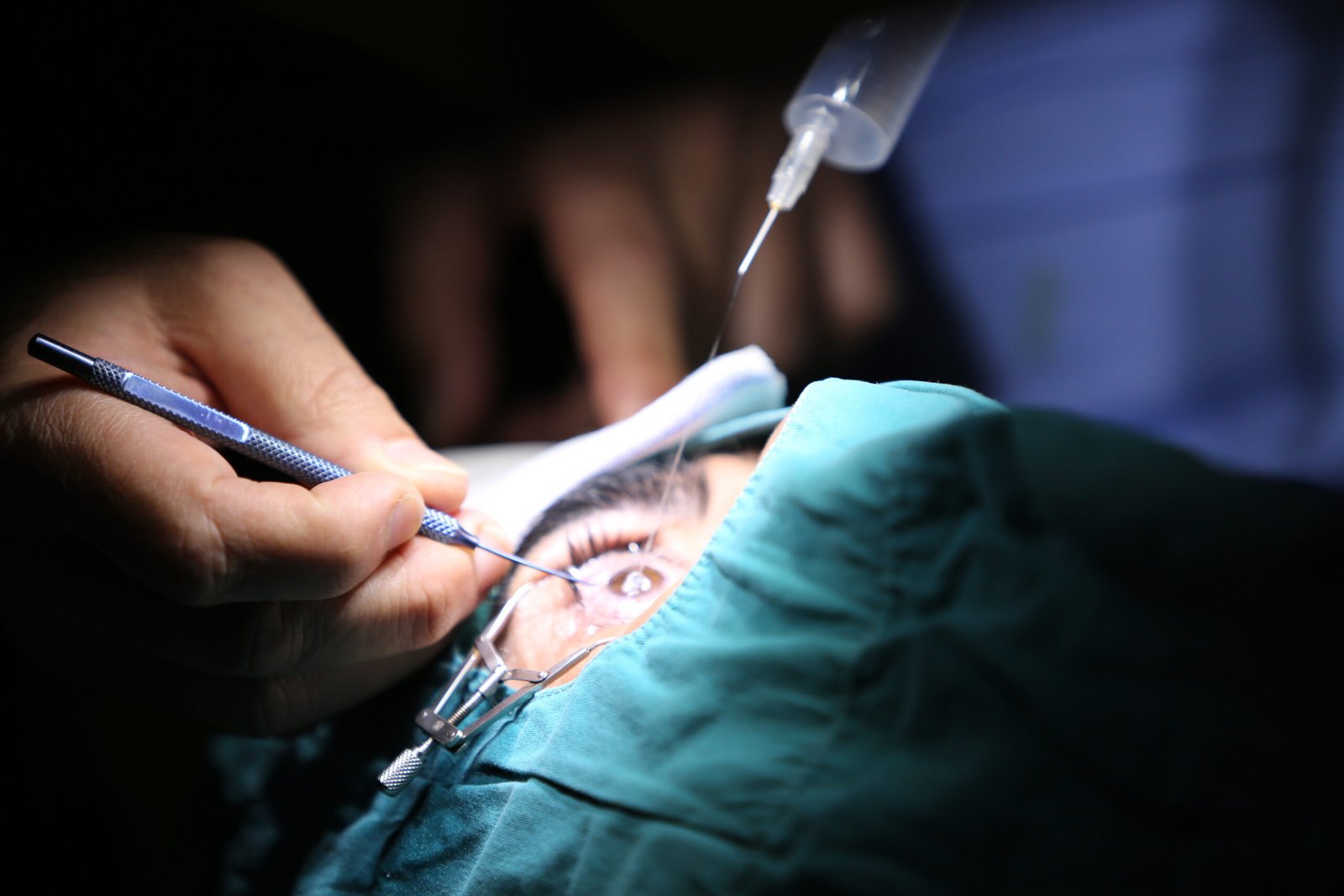 Cataract Surgery in Secunderabad